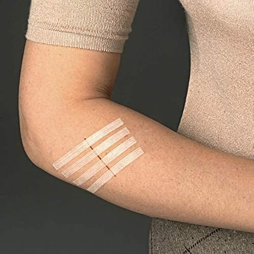 3M Steri-Strip Reinforced Adhesive Skin Closures R1540 – 3 mm × 75 mm